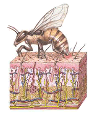 العلاج بسم النحل Beesting