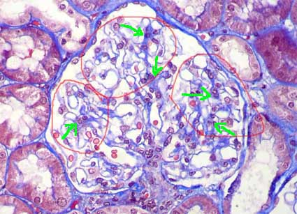 HISTOLOGIA DEL SISTEMA URINARIO Histo_Glomerulo_2