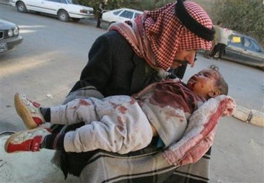 Israel Barbarism ""PICTURES" Iraq_bomb_child