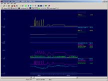 optimisation - Optimisation de l'injection Monopoint et Multipoint Graphs