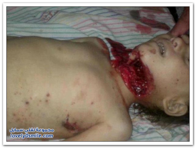 صور أطفال الحولة قبل المجزرة وبعدها . Images-of-the-Hula-massacre-in-Syria-06