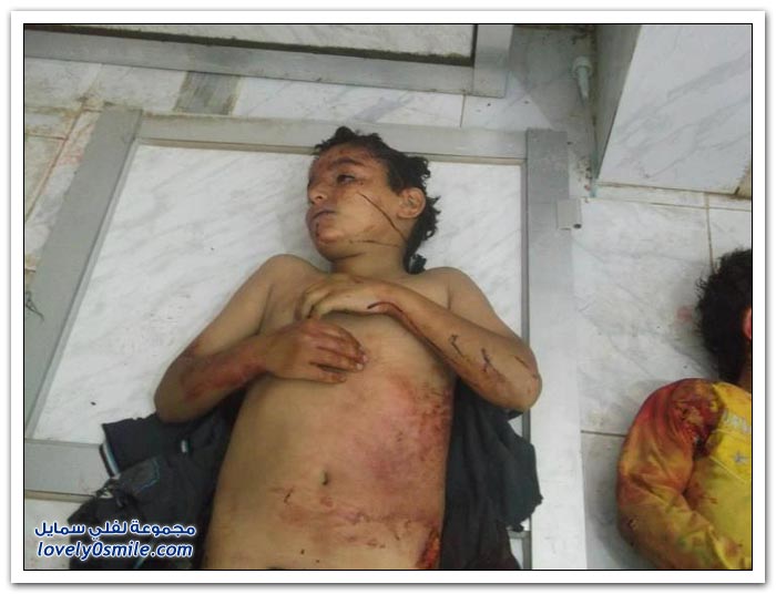 صور أطفال الحولة قبل المجزرة وبعدها . Images-of-the-Hula-massacre-in-Syria-36