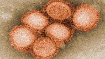اخر اخبار انفلونزا الخنازير في اليمن (الحالات - الاحصائيات - الصور - التقارير ) H1_n1