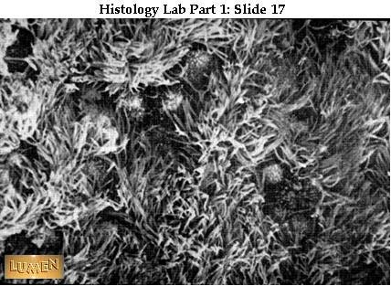 صور طبية هيستولوجى - Histology Hl1-17
