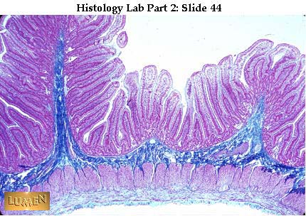 صور طبية هيستولوجى - Histology Hl1A-44