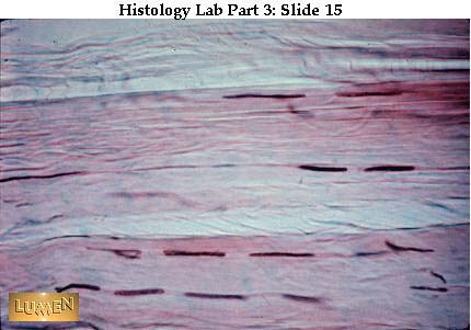 صور طبية هيستولوجى - Histology Hl2-15