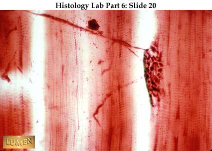 صور طبية هيستولوجى - Histology Hl3-20