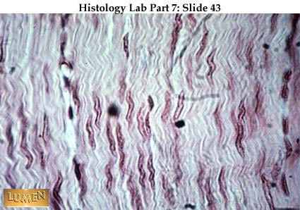 صور طبية هيستولوجى - Histology Hl3A-43