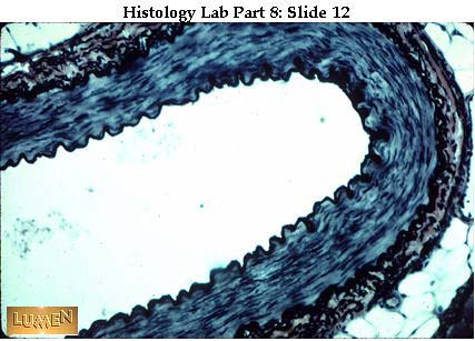 صور طبية هيستولوجى - Histology Hl4-12