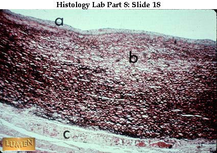 صور طبية هيستولوجى - Histology Hl4-18