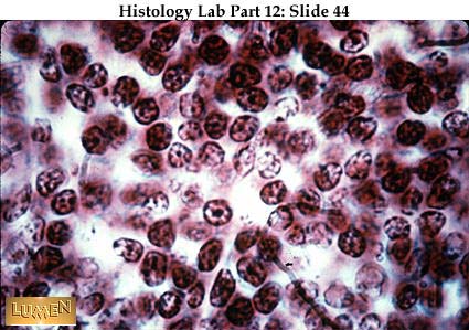 صور طبية هيستولوجى - Histology Hl5A-44