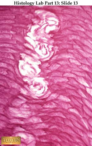 صور طبية هيستولوجى - Histology Hl6-13