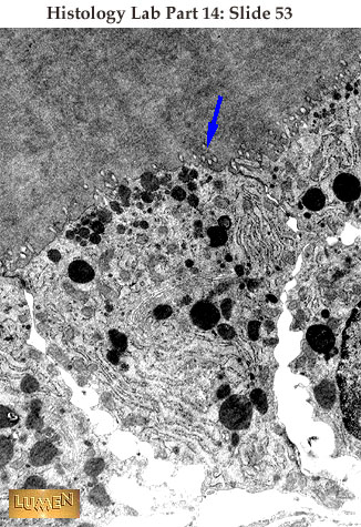 صور طبية هيستولوجى - Histology Hl6A-53