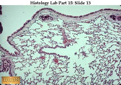 صور طبية هيستولوجى - Histology Hl7-13