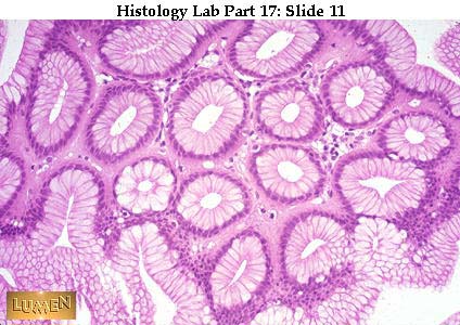 صور طبية هيستولوجى - Histology Hl8-11