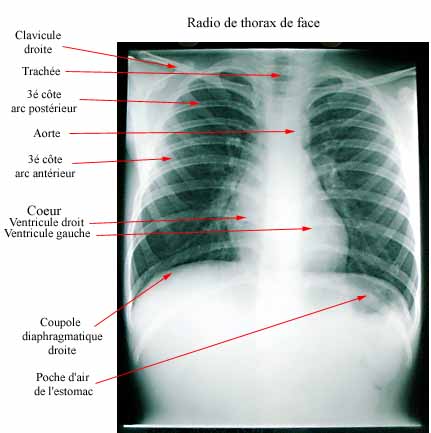 cage thoracique Thorax