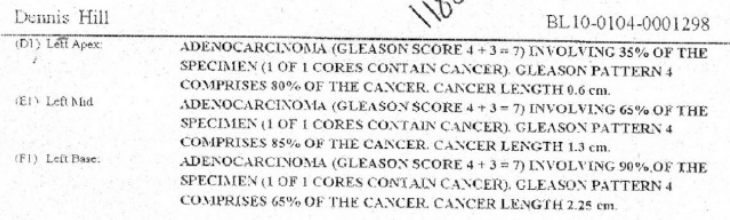 Former Cancer Researcher Chooses Cannabis Over Chemotherapy, Cures His Prostate Cancer Prostate-4