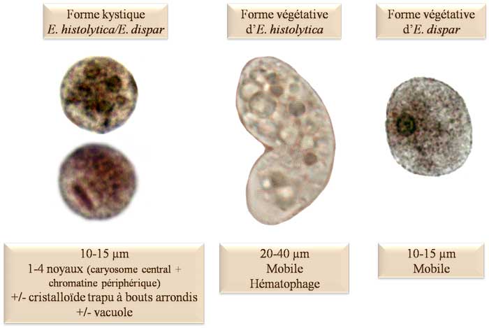 Amibiase (Entamoeba histolytica) Amibe_id