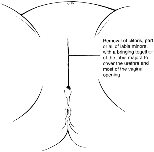 بعض المعلومات عن الخفاض الفرعوني  Type-III-fgm