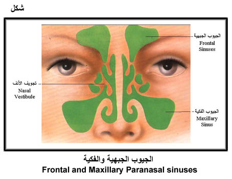 الموسوعة الصحية المصغرة  التهاب الجيوب Fig04