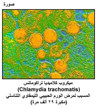  الموسوعة الصحية المصغرة الإدمان، المخدرات،الموت من وجهة النظر (الطبية) Pic08