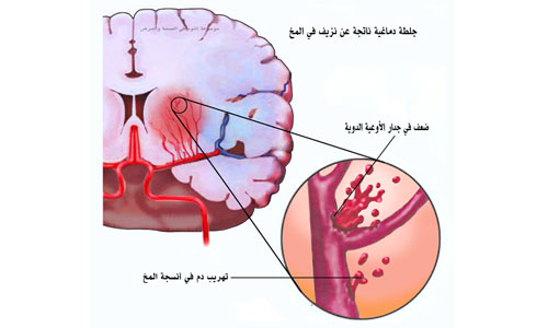 علاقة الغضب بالصحة 01