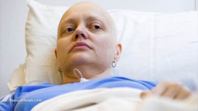 Unbelievable scam of cancer industry blown wide open Cancer-Patient-Dying-Sick-Chemo-Bald