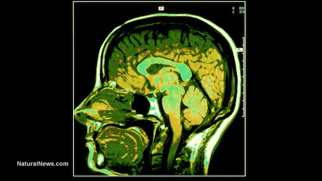 AB blood types have 82 percent higher risk of dementia - learn how to improve brain health naturally Green-Brain-Scan