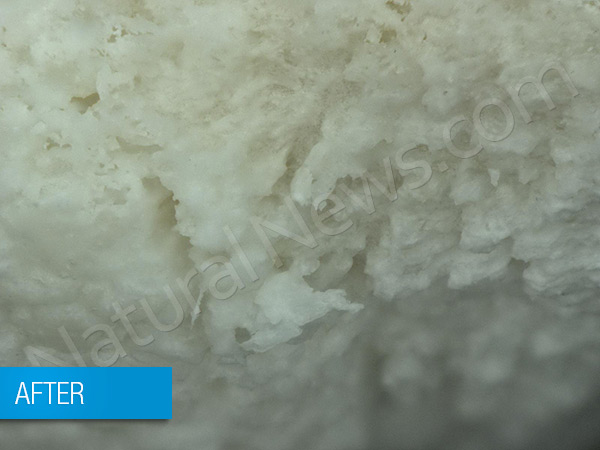 Phosphoric acid used in soda pop shown dissolving teeth  Teeth-After-201-600