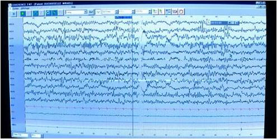 TÉLÉPHONES PORTABLES ET CONTRÔLE COMPORTEMENTAL Graphes_cerveau_500