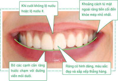 Thế nào là nụ cười đẹp? Nu-cuoi-dep-hoan-hao-7