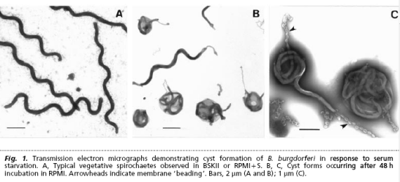 Multiple sclerosis is Lyme disease: Anatomy of a cover-up Borrelia-cysts1