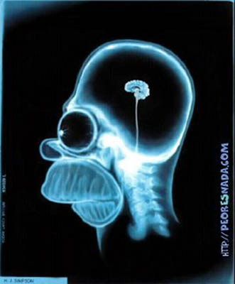 Humor grafico - Página 11 Xrays