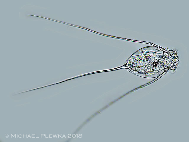 Qu'est-ce qu'un Rotifère ? Filinia-longiseta7003d