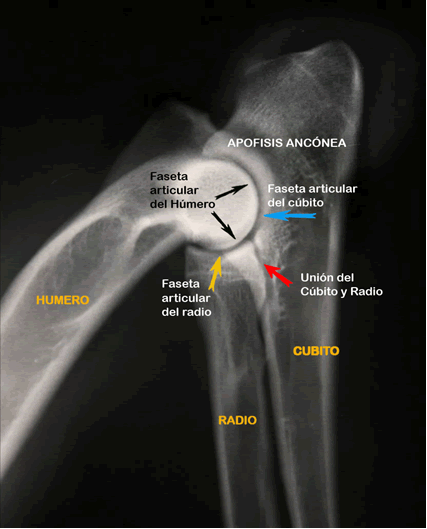 ARTICULACIONES - Displasia de codo Displasia-codo