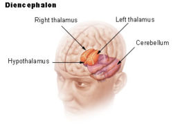 ـداعي الجسد لإصابة عضو معجزة نبوية 1231500811250px-illu_diencephalon_