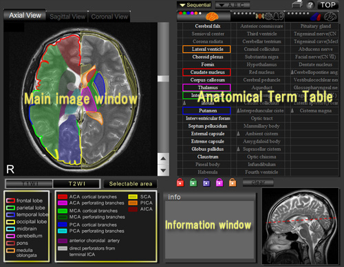 CT and MRI Interactive Atlas of Cross-Sectional Anatomy Top1