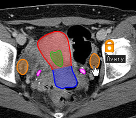 CT and MRI Interactive Atlas of Cross-Sectional Anatomy Top5