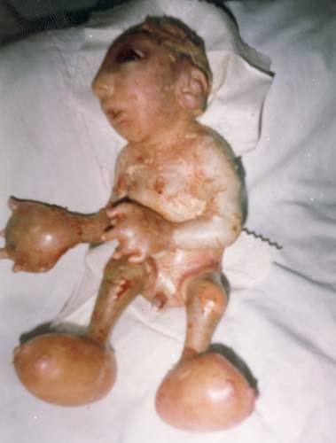  This Will Make You Sick ~ Depleted Uranium Contaminat​ion - A Crime Against Humanity Df25