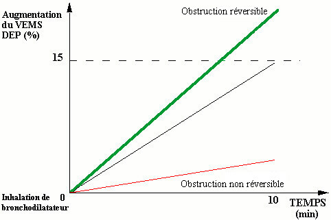 Test de réversibilité aux broncholidateurs  TestBeta3