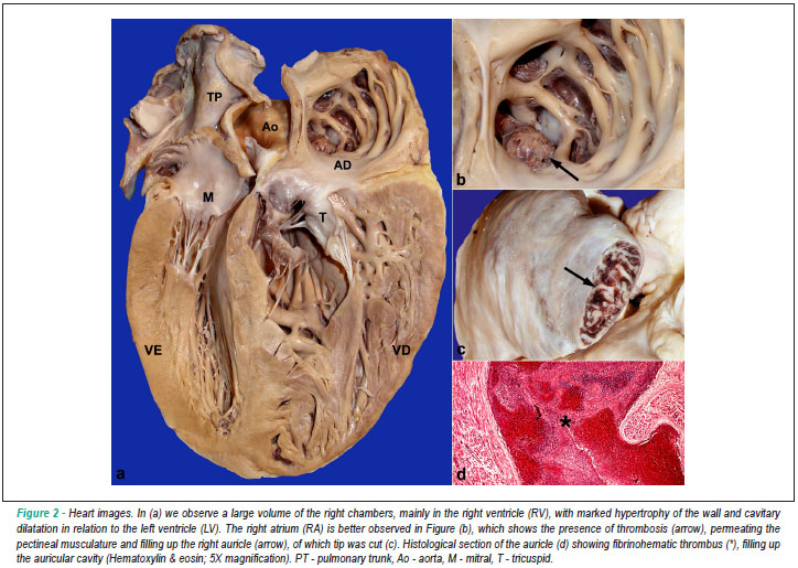 KARDIOLOGIJA En_a14fig02