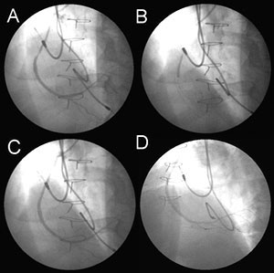 anaalisis historia clinica oscar saurith  Fig04-03