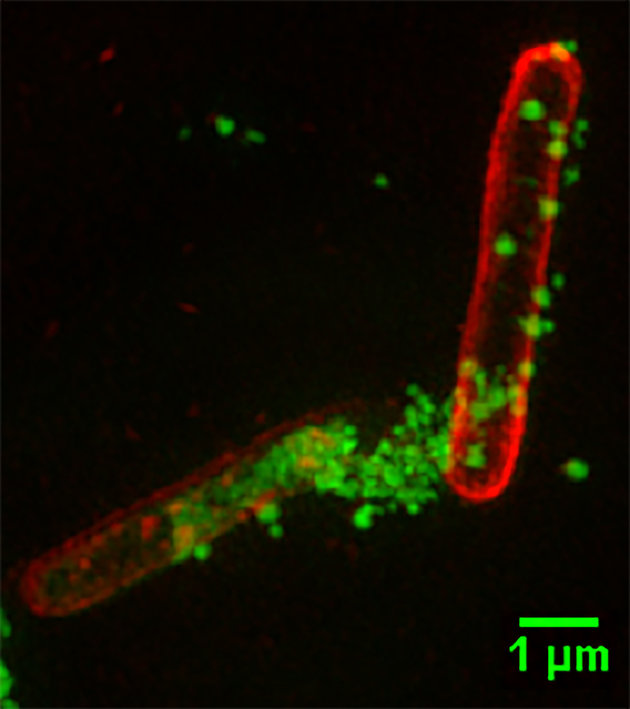 25-year-old student has just come up with a way to fight drug-resistant superbugs without antibiotics 57d7b2081300002a0039b9da