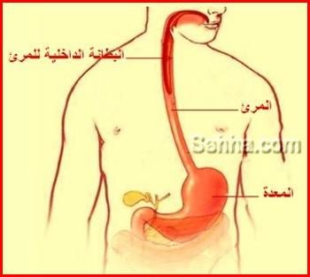 سرطان المريء Esophageal cancer Esophageal_cancer03