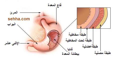 سرطان المعدة Gastric cancer Gastric-cancer03