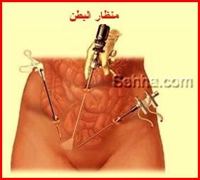 كل ما تريد معرفته عن السرطان Ovarian-Cancer05