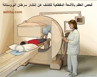 كل ما تريد معرفته عن السرطان Prostate_cancer10