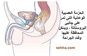 كل ما تريد معرفته عن السرطان Prostate_cancer15