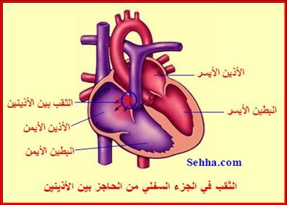 أمراض القلب و الجهاز الدوري Cardiovascular diseases ASD05