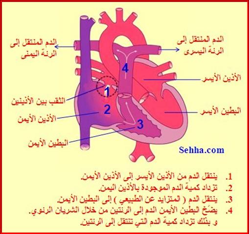 أمراض القلب و الجهاز الدوري Cardiovascular diseases ASD08